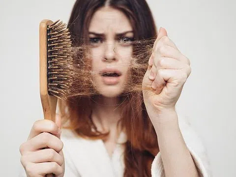 Thực phẩm nào có tác dụng ngăn rụng tóc mà bạn không ngờ tới?